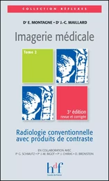 IMAGERIE MEDICALE RADIO CONVENTIONNELLE T2