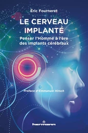 Le cerveau implanté