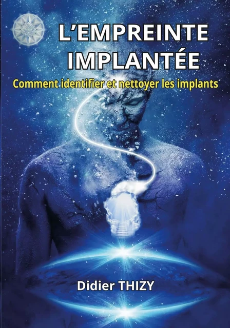 L’EMPREINTE IMPLANTÉE - Didier Thizy - ABATOS