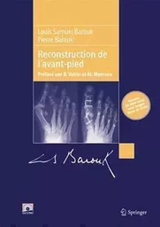 Reconstruction de l'avant-pied