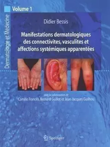 Manifestations dermatologiques des connectivites, vasculites et affections systémiques apparentées - Didier Bessis, Jean-Jacques Guilhou, Bernard Guillot, Camille Francès - SPRINGER PARIS