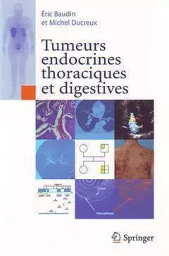 Tumeurs endocrines thoraciques et digestives - Eric Baudin, Michel Ducreux - SPRINGER PARIS