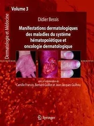 Manifestations dermatologiques des maladies du système hématopoïétique et oncologie dermatologique