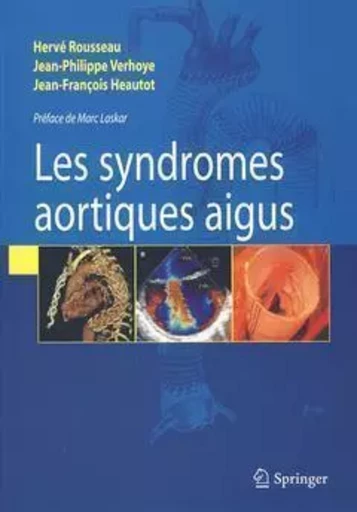 Syndromes aortiques aigus - Hervé Rousseau, Jean-Philippe Verhoye, Jean-François Heautot - SPRINGER PARIS