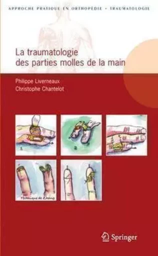 La traumatologie des parties molles de la main - Philippe Liverneaux, Christophe Chantelot - SPRINGER PARIS