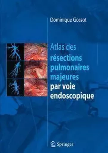 Atlas des résections pulmonaires majeures par voie endoscopique - Dominique Gossot - SPRINGER PARIS