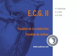 ECG II : Troubles de la conduction, troubles du rythme