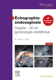 Échographie endovaginale Doppler - 3D