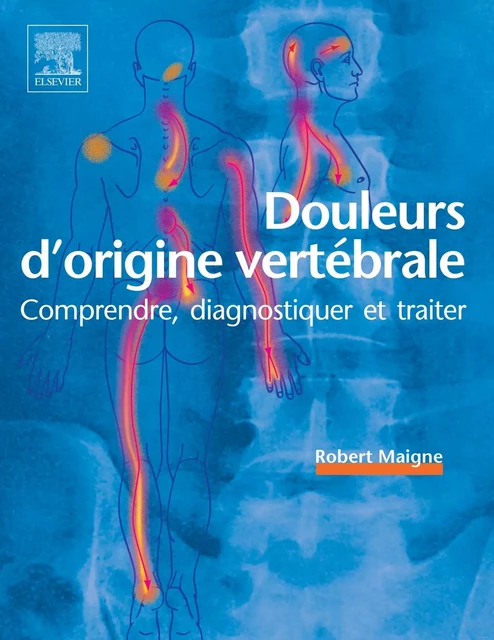 Douleurs d'origine vertébrale - Robert Maigne - MASSON