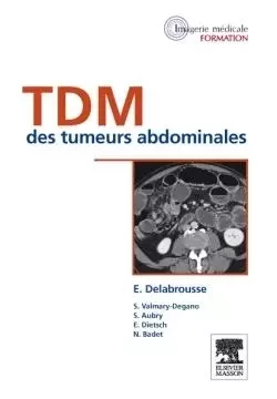 TDM des tumeurs abdominales - Eric Delabrousse, Séverine Valmary-Degano, Sébastien Aubry, Emmanuel Dietsch, Nicolas Badet - MASSON