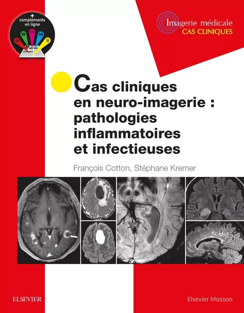 Cas cliniques en neuro-imagerie : pathologies inflammatoires et infectieuses - François Cotton, Stéphane Kremer - MASSON