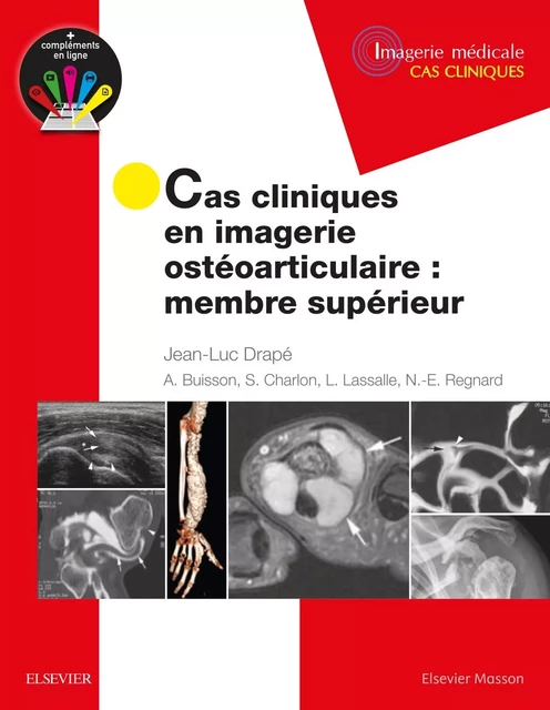 Cas cliniques en imagerie ostéoarticulaire : membre supérieur - Jean-Luc Drapé - MASSON