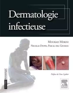 Dermatologie infectieuse - Mourad Mokni - MASSON