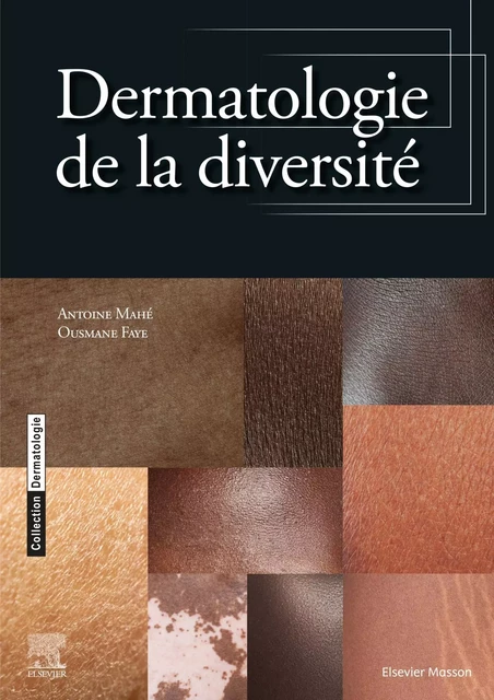 Dermatologie de la diversité - Antoine Mahé, Ousmane FAYE - MASSON