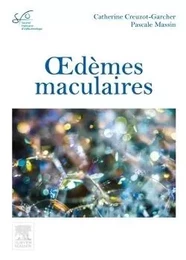 Oedèmes maculaires