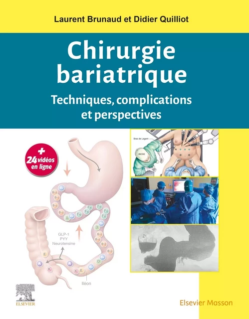 Chirurgie bariatrique - Laurent Brunaud, Didier Quilliot - MASSON