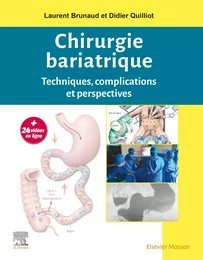 Chirurgie bariatrique