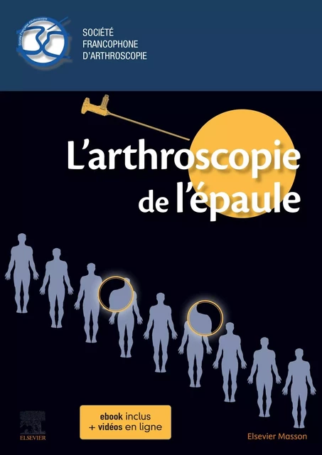 L'arthroscopie de l'épaule -  Société Francophone d'Arthroscopie, Christel Conso - MASSON