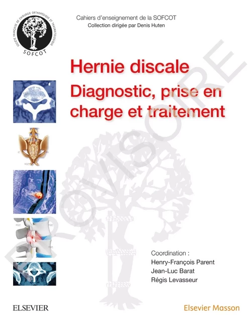 La hernie discale lombaire - Henry-François Parent, Jean-Luc Barat, Régis Levasseur,  SOFCOT - MASSON