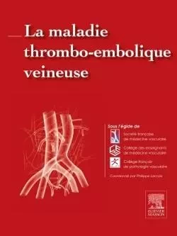 La maladie thrombo-embolique veineuse -  Société Française de Médecine Vasculaire (SFMV),  Collège des enseignants de médecine vasc,  Collège Français de Pathologie Vasculaire, Philippe LACROIX - MASSON