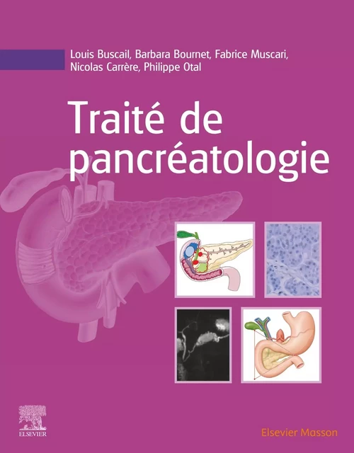 Traité de pancréatologie - Louis Buscail, Barbara Bournet, Fabrice Muscari, Nicolas Carrère, Philippe Otal - MASSON