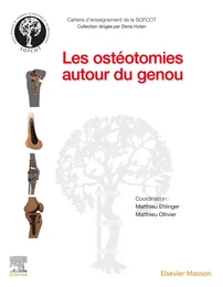 Les ostéotomies autour du genou