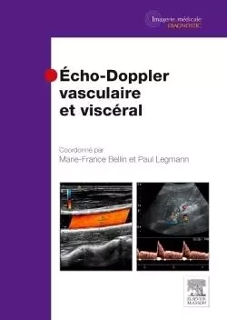 Echo-Doppler vasculaire et viscéral - Marie-France Bellin, Paul Legmann - MASSON