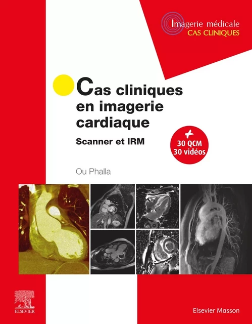 Cas cliniques en imagerie cardiaque - Phalla OU - MASSON