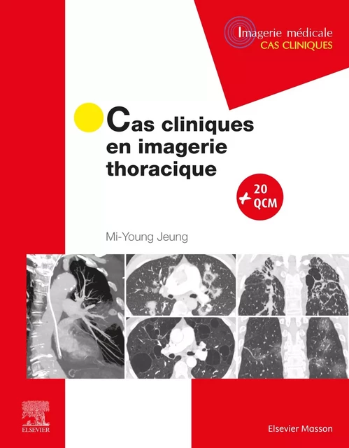 Cas cliniques en imagerie thoracique - Mi-Young Jeung - MASSON