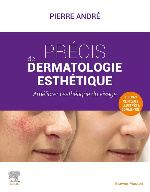 Précis de dermatologie esthétique - Pierre ANDRÉ - MASSON