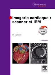 Imagerie cardiaque : scanner et IRM