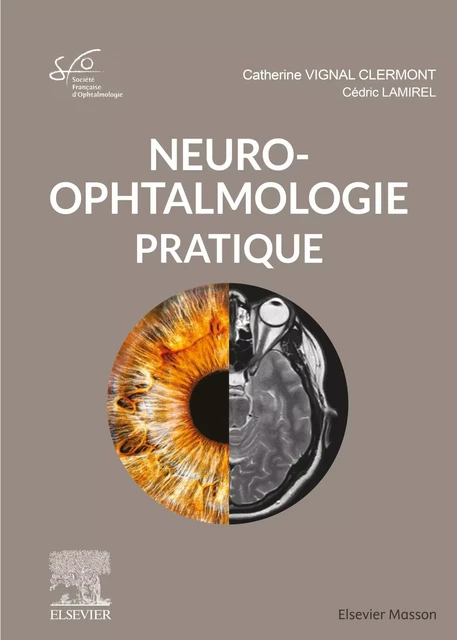 Neuro-ophtalmologie pratique -  Société Française d'Ophtalmologie (SFO), Catherine Vignal-Clermont, Cédric Lamirel - MASSON