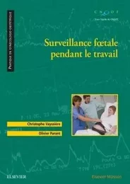 Surveillance foetale pendant le travail