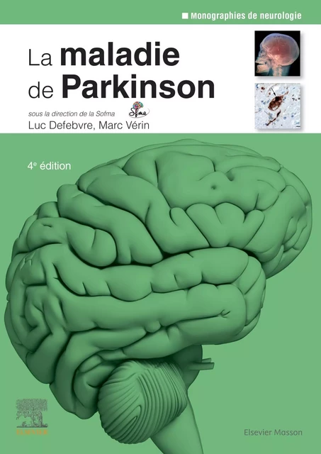 La maladie de Parkinson -  SOFMA, Luc Defebvre, Marc Vérin - MASSON