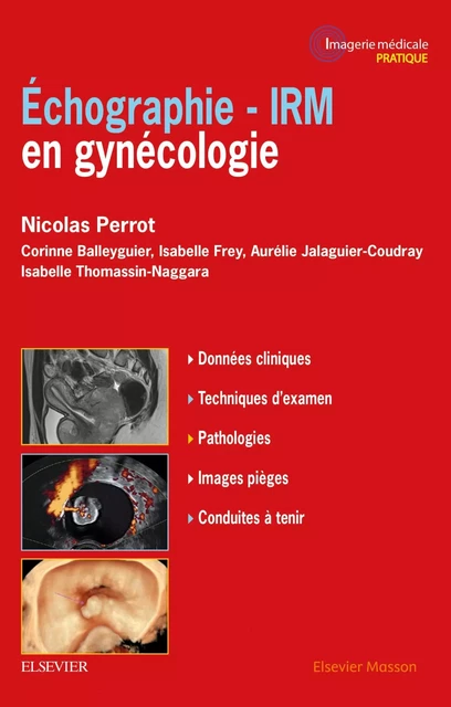 Echographie - IRM en gynécologie - Nicolas PERROT - MASSON