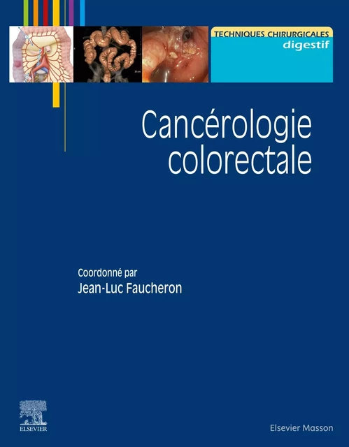 Cancérologie colorectale - Jean-Luc Faucheron - MASSON