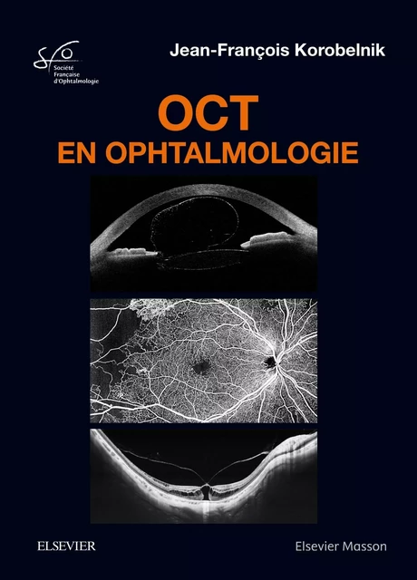 OCT en ophtalmologie -  Société Française d'Ophtalmologie (SFO), Jean-François Korobelnik - MASSON