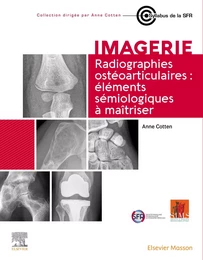 Radiographies ostéoarticulaires : éléments sémiologiques à maitriser