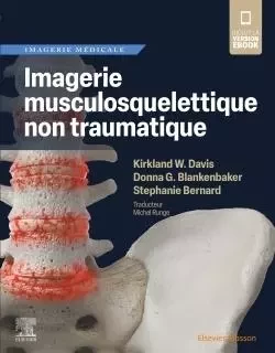 Imagerie musculosquelettique non traumatique - Kirkland W. Davis, Donna G Blankenbaker, Stéphanie BERNARD - MASSON