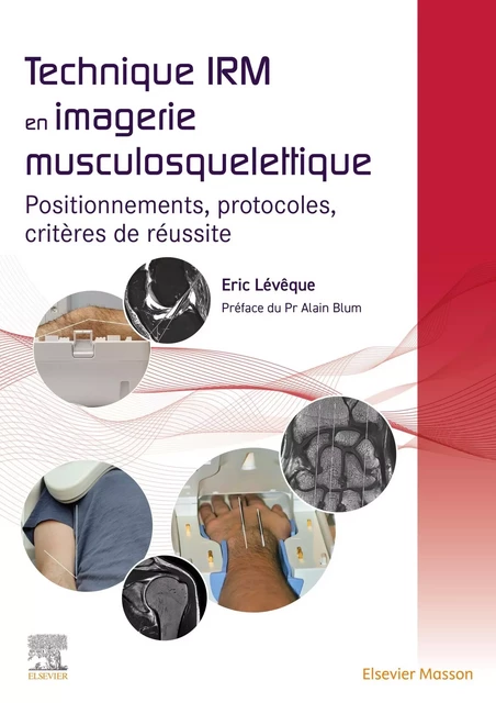 Technique IRM en imagerie musculosquelettique - Eric Lévêque - MASSON