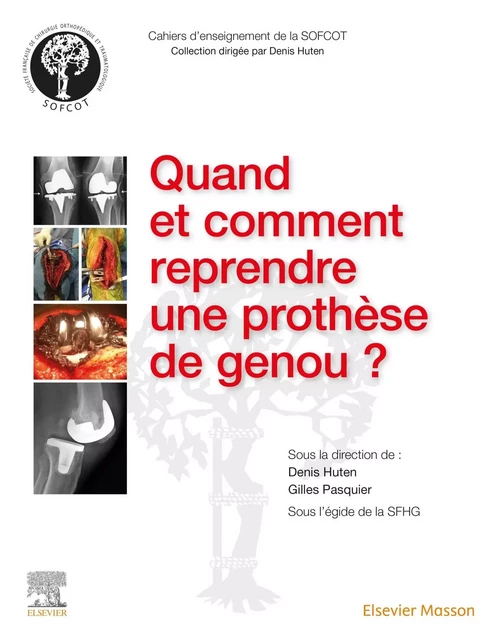 Quand et comment reprendre une prothèse de genou ? - Denis Huten, Gilles-Jean-Marie Pasquier - MASSON