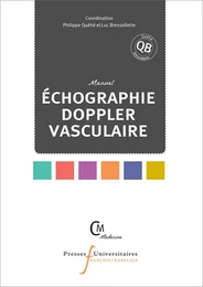 Echographie doppler vasculaire