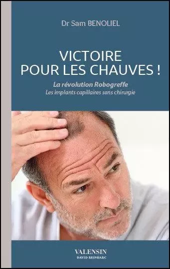 Victoire pour les chauves ! - Sam Benoliel - Editions David Reinharc