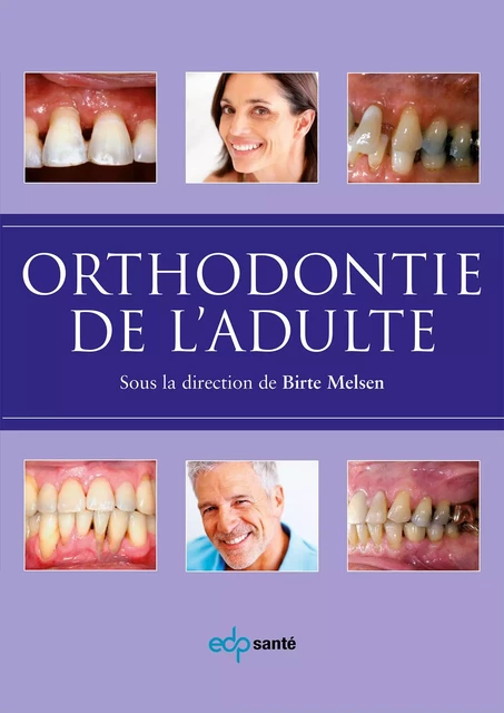 Orthodontie de l'adulte - Birte Melsen - PARRESIA