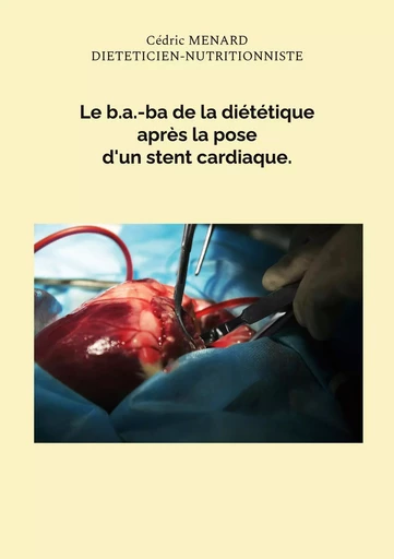 Le b.a.-ba de la diététique après la pose d'un stent cardiaque. - Cédric Menard - BOOKS ON DEMAND