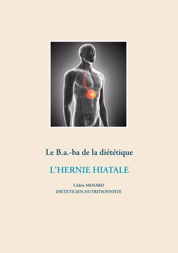 Le B.a.-ba diététique de l'hernie hiatale - Cédric Menard - BOOKS ON DEMAND