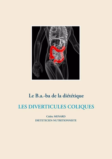 Le B.a.-Ba. diététique pour les diverticules coliques - Cédric Menard - BOOKS ON DEMAND