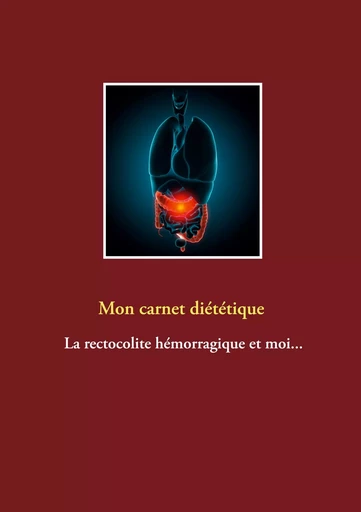 Mon carnet diététique : la rectocolite hémorragique et moi... - Cédric Menard - BOOKS ON DEMAND