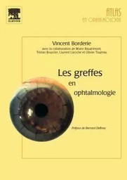 Les greffes en ophtalmologie