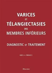 Varices et teleangiecasties des membres inferieurs